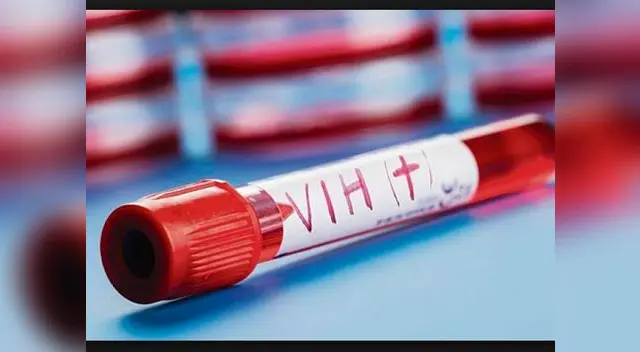 VIH ha sido tratado por científicos en España