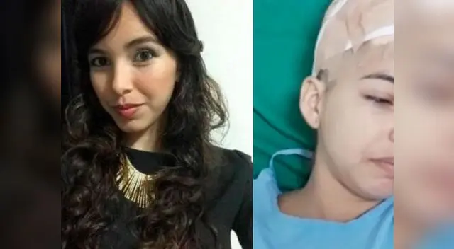 Colombiana Kenede Susana Vega Garizao estuvo cerca de perder todo el cabelludo Colombiana Kenede Susana Vega Garizao estuvo cerca de perder todo el cabelludo