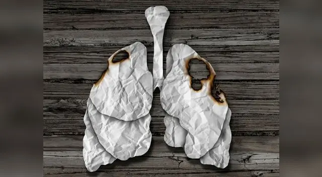 Existen innovadoras opciones terapéuticas disponibles en Perú que mejoran la calidad de vida del paciente con cáncer Existen innovadoras opciones terapéuticas disponibles en Perú que mejoran la calidad de vida del paciente con cáncer