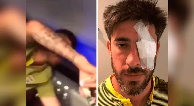 Futbolistas de Boca Juniors fueron atacados con piedras y gas pimienta