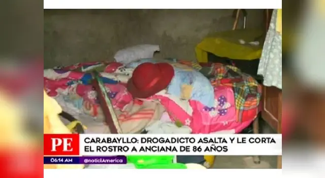 Anciana fue asaltada en Carabayllo Anciana fue asaltada en Carabayllo