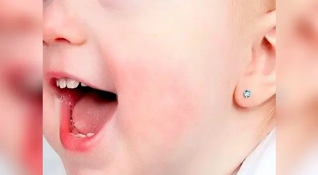 Infórmate bien antes de perforar las orejas a tu bebé Infórmate bien antes de perforar las orejas a tu bebé