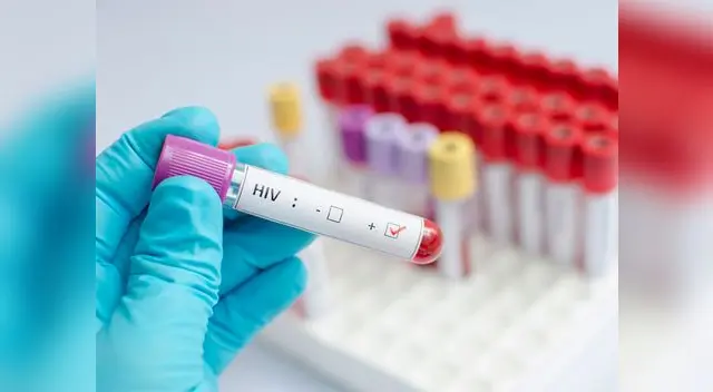 Hoy 1 de diciembre se conmemora Día Mundial de la Lucha contra el Sida Hoy 1 de diciembre se conmemora Día Mundial de la Lucha contra el Sida