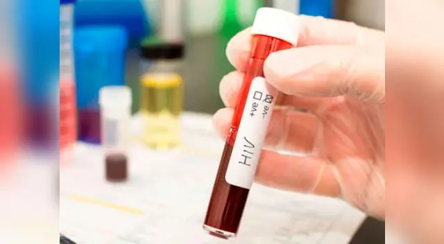 Dos menores de edad fueron diagnosticados con VIH en Piura Dos menores de edad fueron diagnosticados con VIH en Piura