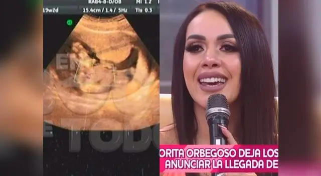 Dorita Orbegoso confirma que será madre 