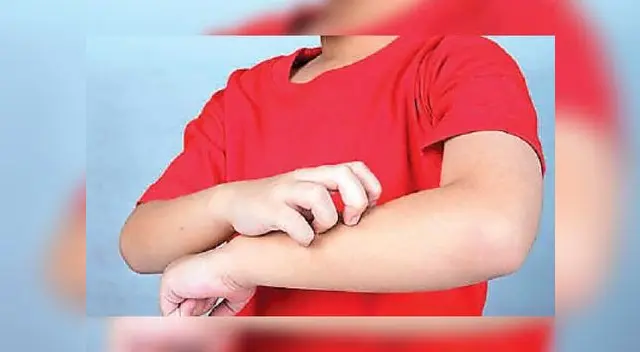 Esta enfermedad podría requerir tratamientos más extensos Esta enfermedad podría requerir tratamientos más extensos