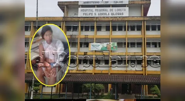 La víctima tiene el 25 % del cuerpo quemado La víctima tiene el 25 % del cuerpo quemado