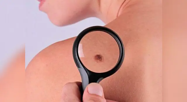 La clave está en autoexaminarse para prevenir La clave está en autoexaminarse para prevenir