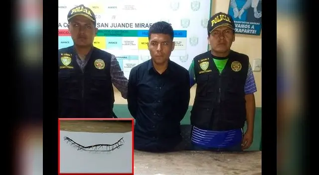 Pedía dinero utilizando falsa cicatriz