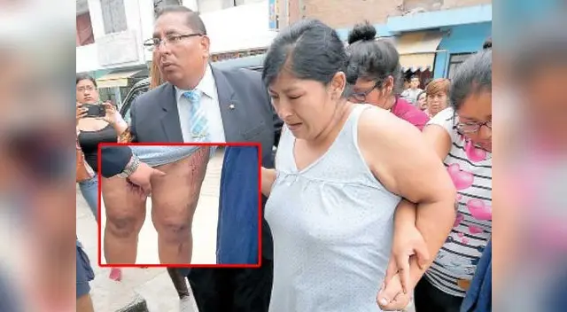 Agraviada está indignada y pide que encierren a su atacante Agraviada está indignada y pide que encierren a su atacante