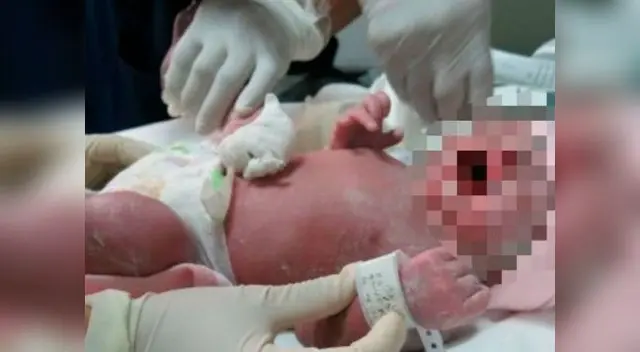 A bebé le cortaron el cuello y el tórax en Argentina A bebé le cortaron el cuello y el tórax en Argentina