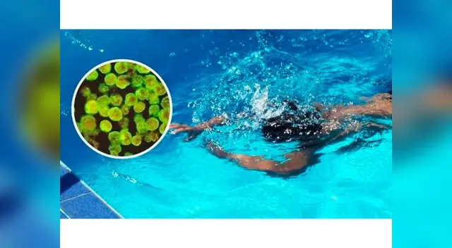 Ameba comecerebros afecta a niña de año y 11 meses de nacida