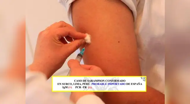Diris de Lima Este confirmó rebrote de sarampión en Lima Diris de Lima Este confirmó rebrote de sarampión en Lima