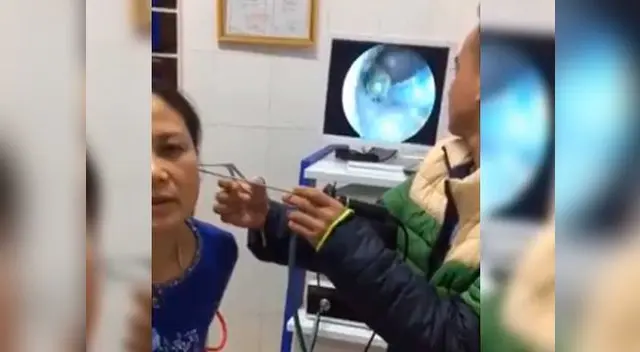 Médico retiró insecto del cuerpo de la mujer