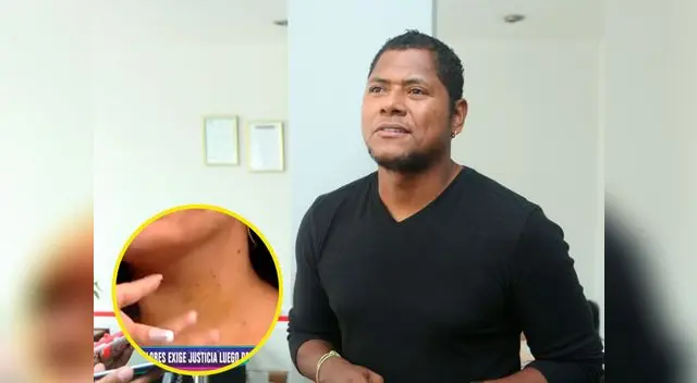 Nataly Jara reveló el miedo que sintió cuando Juan 'Chiquito' Flores la comenzó agredir de manera descontrolada Nataly Jara reveló el miedo que sintió cuando Juan 'Chiquito' Flores la comenzó agredir de manera descontrolada