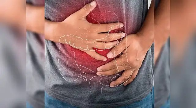 Pacientes con enfermedades inflamatorias intestinales tienen alto riesgo de sufrir cáncer colorrectal