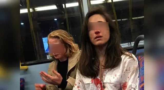 Cuatro sujetos atacaron a la pareja por su negativa a un beso público