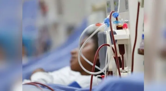 Mujer falleció por el Síndrome Guillian Barré en Trujillo 