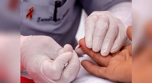 Por el Día nacional de la prueba de VIH, se desarrollará campañas 