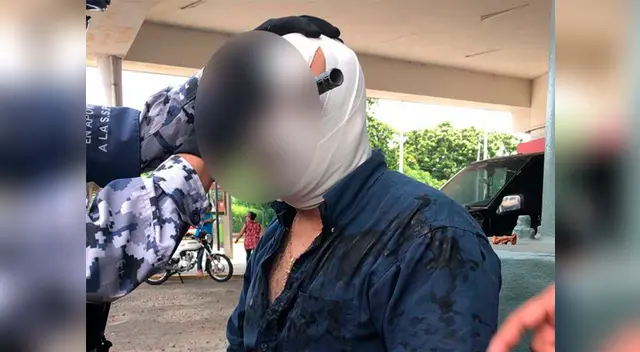 El hombre de 50 años hablaba con el desarmador incrustado mientras su familia lloraba