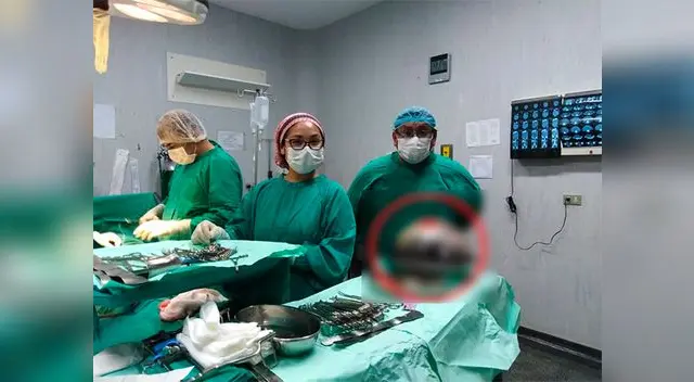 Médicos del Hospital de Ventanilla salvaron a mujer Médicos del Hospital de Ventanilla salvaron a mujer