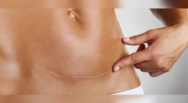 Debes estar atenta a la herida y revisar cómo va su evolución Debes estar atenta a la herida y revisar cómo va su evolución