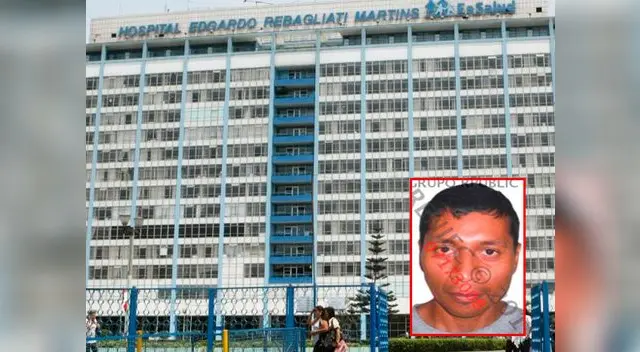 Hospital Rebagliati indica que feminicida de SJL fue dado de alta Hospital Rebagliati indica que feminicida de SJL fue dado de alta