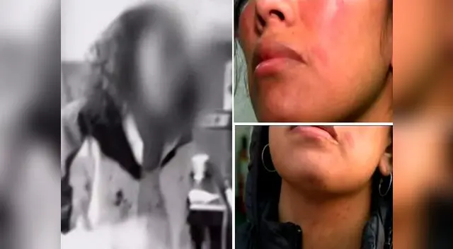Mujer fue agredida pese a contar con medidas de protección  