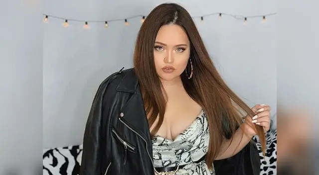 Susan Pietro se hizo la banda gástrica y su estómago ahora mide dos centímetros