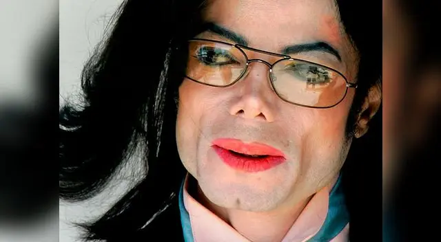 Michael Jackson estaba totalmente calvo y con cicatrices cuando murió Michael Jackson estaba totalmente calvo y con cicatrices cuando murió