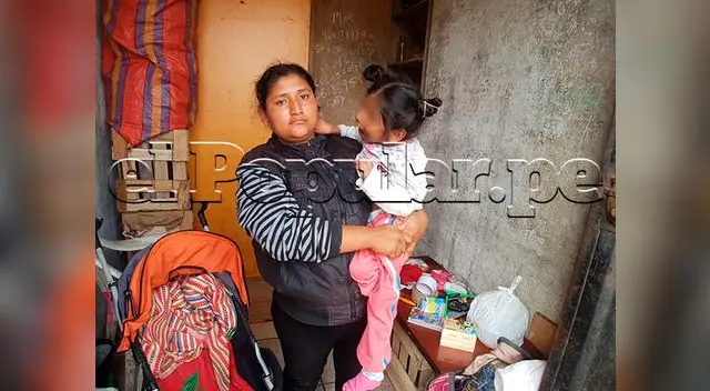 Madre de El Agustino pide ayuda para su hija con microcefalia