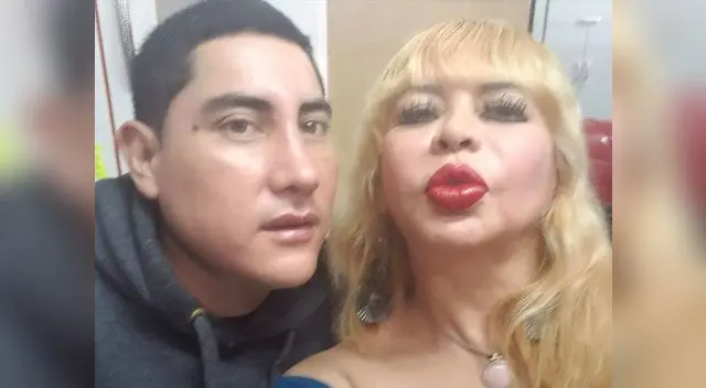 Susy Díaz está emocionada por los resultados de la operación a la nariz Susy Díaz está emocionada por los resultados de la operación a la nariz