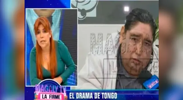 La conductora Magaly Medina entrevistó a Tongo por su situación de salud, pero terminó en discusión