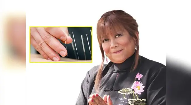 La acupuntura es uno de los pilares de la medicina China