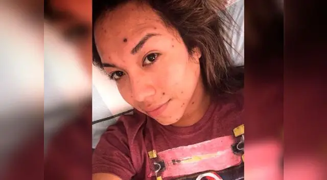 Dayanita no fue a grabar en El Wasap de JB por sufrir varicela Dayanita no fue a grabar en El Wasap de JB por sufrir varicela