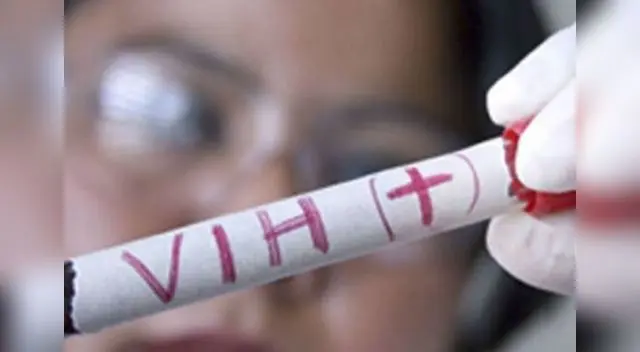 Solo con el control de la infección en forma permanente se puede tener una buena calidad de vida