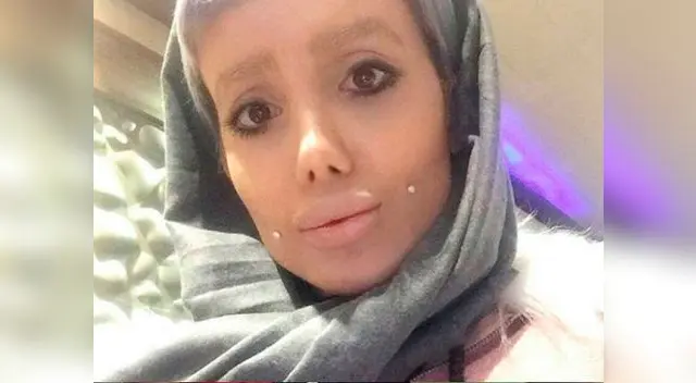 Influencer se hizo más de 50 operaciones estéticas