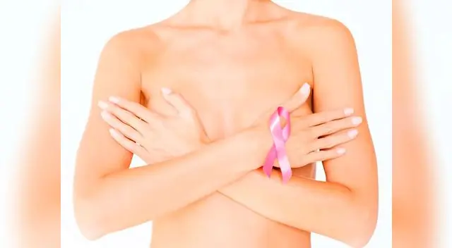 Las irregularidades en el contorno de las mamas y el cambio de tamaño de alguna de ellas son algunos de los síntomas tempranos más frecuentes de cáncer de mama