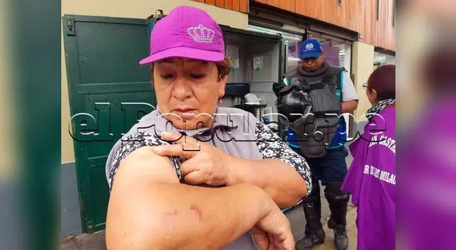 Mujeres agredidas deberán pasar por el médico legista