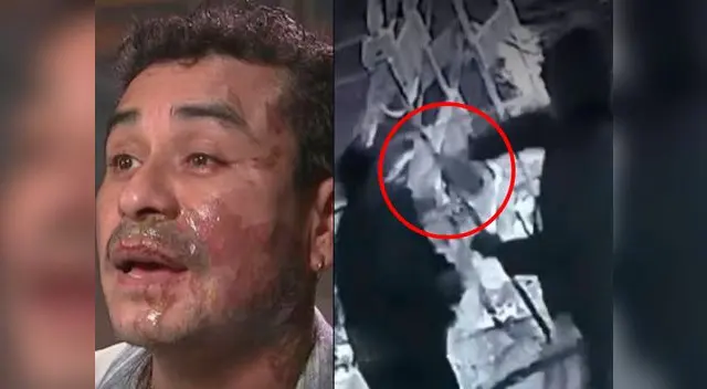 Estadounidense arrojó ácido a peruano en medio de una discusión 