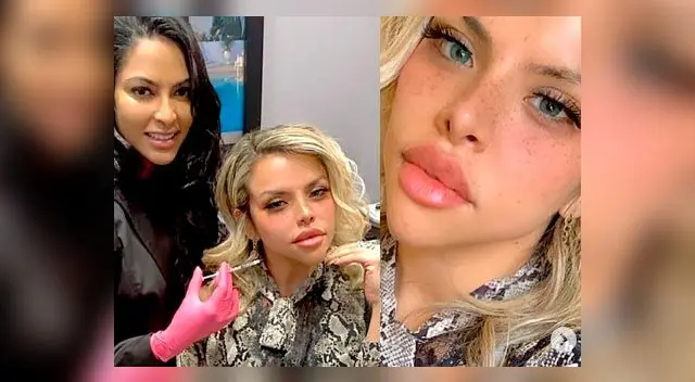 Josetty Hurtado causa polémica en Instagram al registrar sus nuevos cambios estéticos en la cara Josetty Hurtado causa polémica en Instagram al registrar sus nuevos cambios estéticos en la cara