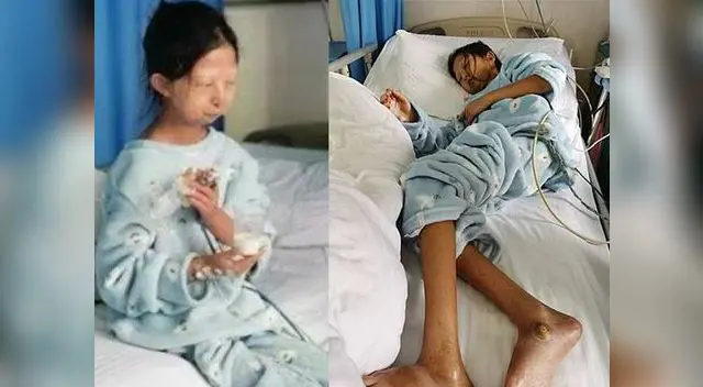 La estudiante apenas pesa poco más de 20 kilos La estudiante apenas pesa poco más de 20 kilos