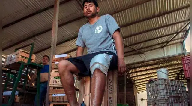 La víctima recibió un disparo en la pierna La víctima recibió un disparo en la pierna