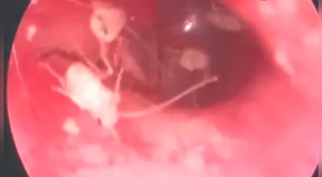 Joven nunca olvidará experiencia en consulta ambulatoria