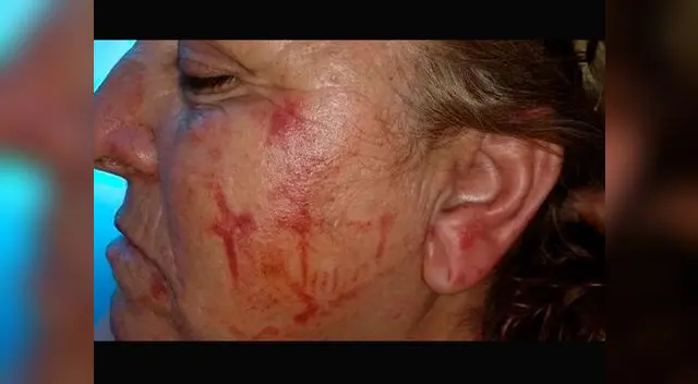 La sexagenaria se resistió a soltar la mochila pese a que su vida corría peligro La sexagenaria se resistió a soltar la mochila pese a que su vida corría peligro