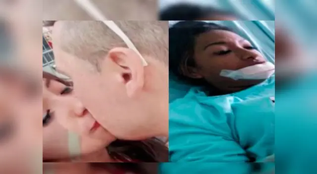 Sujeto arrancó labio de su pareja por celos Sujeto arrancó labio de su pareja por celos