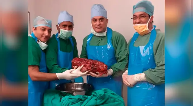 El riñón del paciente medía 45 centímetros y pesaba más de 7 kilos El riñón del paciente medía 45 centímetros y pesaba más de 7 kilos