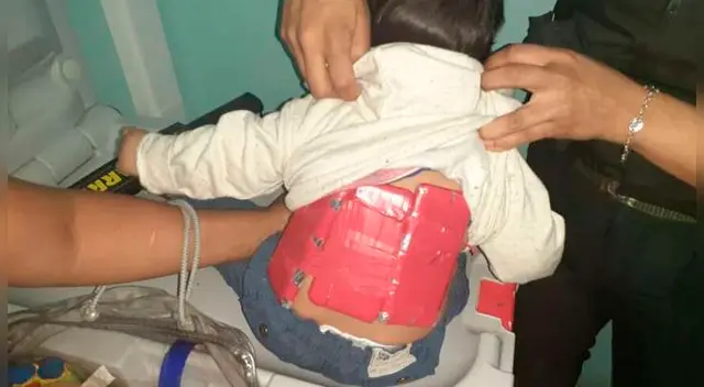 El niño tenía tres celulares forrados con cinta adhesiva en su cuerpo El niño tenía tres celulares forrados con cinta adhesiva en su cuerpo