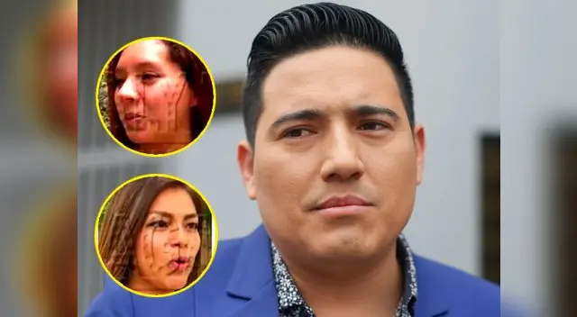 Pedro Loli se encuentra en serios problemas, luego jovencitas afirmen que han vivido un amor clandestino con el cantante