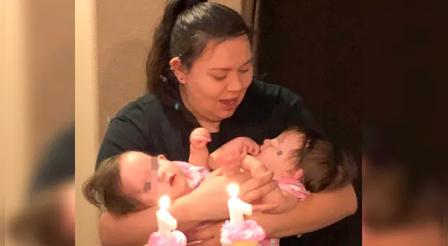 Mujer no piensa someter a sus hijas a una cirugía mientras se encuentren bien